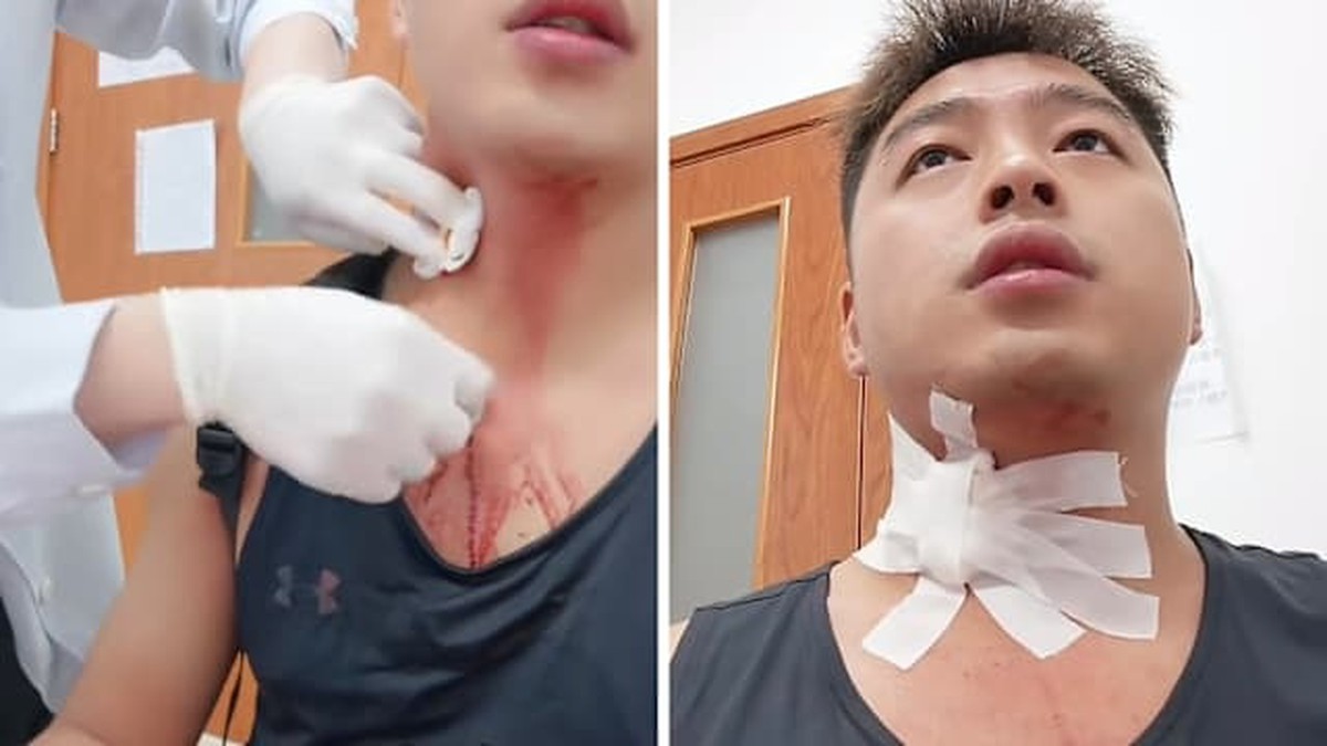 Sự Cố Đáng Chú Ý: Đập Muỗi Gây Chảy Máu Nguy Hiểm Tại Trung Quốc